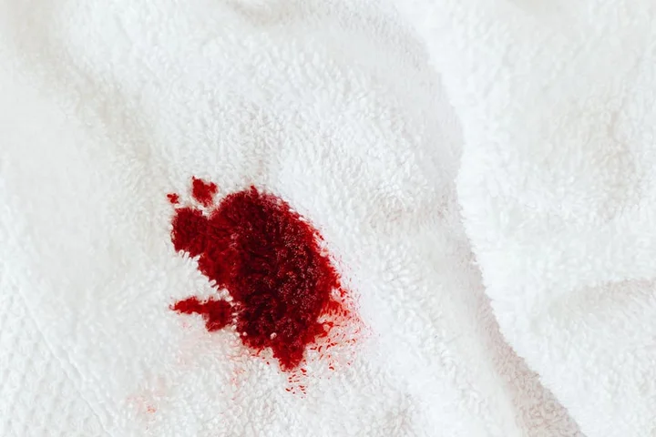 Close-up of a red berry stain on white fabric.
