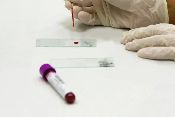 Gloved hands in a laboratory handling a drop of blood on a glass slide, with additional slides and a test tube nearby.