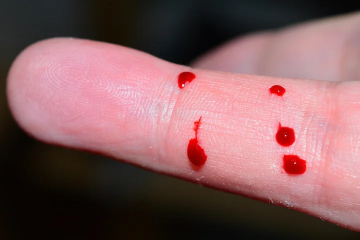 Close-up of a fingertip with small red blood droplets