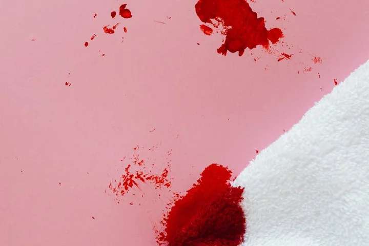 Close-up of a bright red mustard stain on pink fabric with a white towel nearby