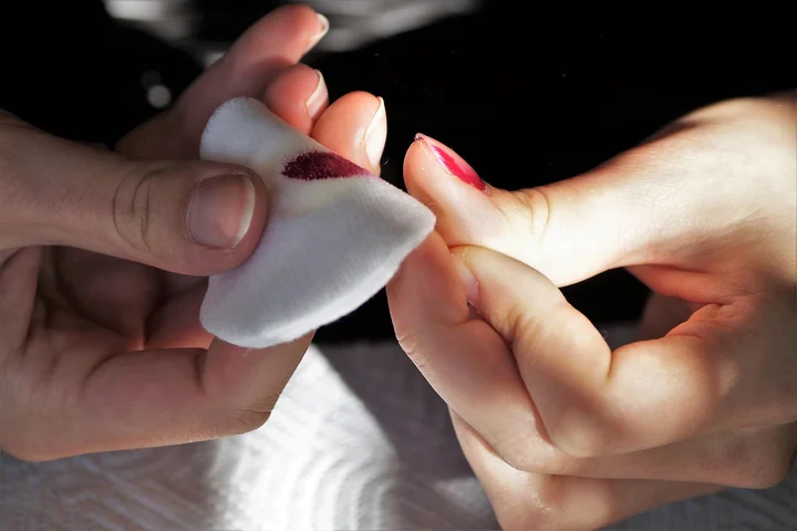 Close-up of hands using a cotton pad to wipe away nail polish from a stained fingernail