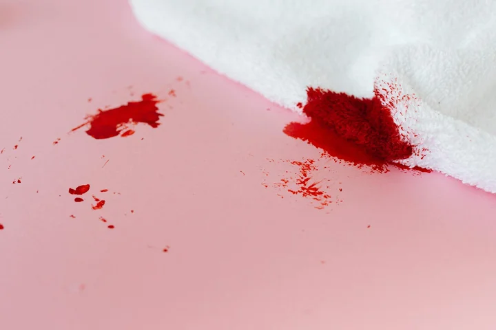 Close-up of red stains on a pale pink surface with a white cloth nearby, illustrating protein- and dairy-based stains such as blood, chocolate, and egg.